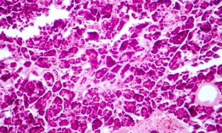 Multimodal AI Prostate Cancer Biomarker Demonstrates Consistency Across Diverse Global Populations