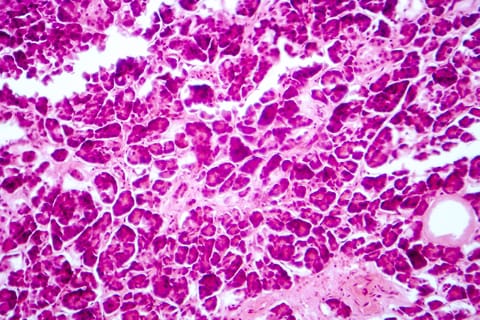 Multimodal AI Prostate Cancer Biomarker Demonstrates Consistency Across Diverse Global Populations