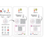 Liquid Biopsy Detects Early Lung Cancer Recurrence Months Before Imaging