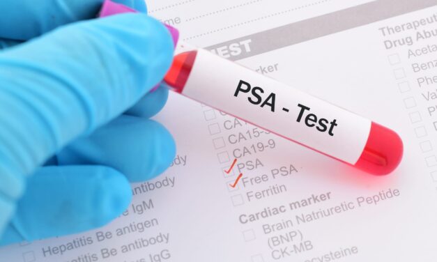Project HOPE Launches Wisconsin Initiative to Expand Prostate Cancer Screening