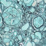 10x Genomics, Fred Hutch Launch Cancer Diagnostics Research Collaboration