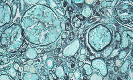 10x Genomics, Fred Hutch Launch Cancer Diagnostics Research Collaboration