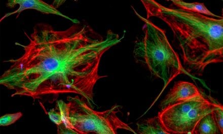 Study Shows Skin Biopsies Can Help Diagnose Mitochondrial Disease