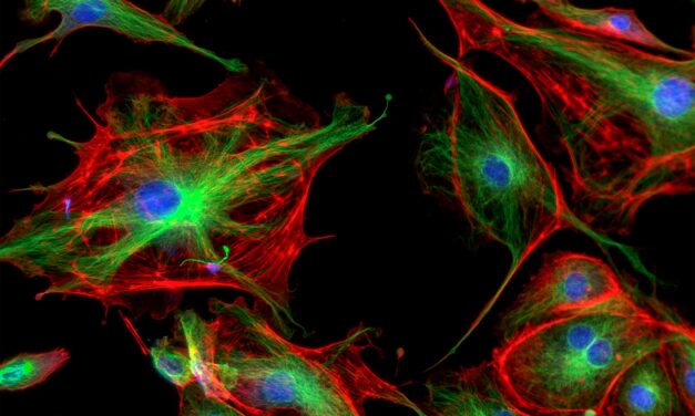 Study Shows Skin Biopsies Can Help Diagnose Mitochondrial Disease
