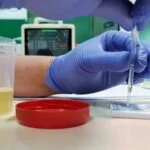 Rapid Urine Test Detects 92% of Invasive Aspergillosis Cases in Study
