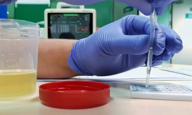 Rapid Urine Test Detects 92% of Invasive Aspergillosis Cases in Study