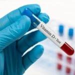 Global Survey Finds Wide Inconsistencies in Bone Biomarker Testing Practices